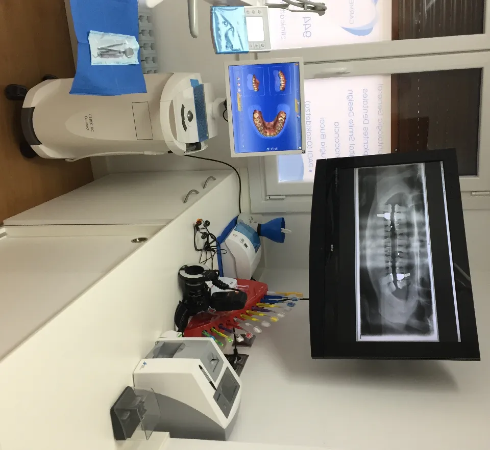 El escáner intraoral junto a una pantalla que muestra una radiografía panorámica